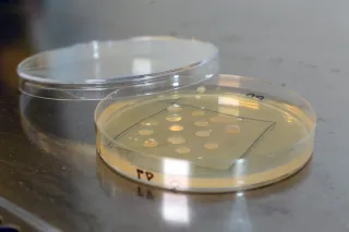 Photo of petri dish containing plasticdegrading microbes.